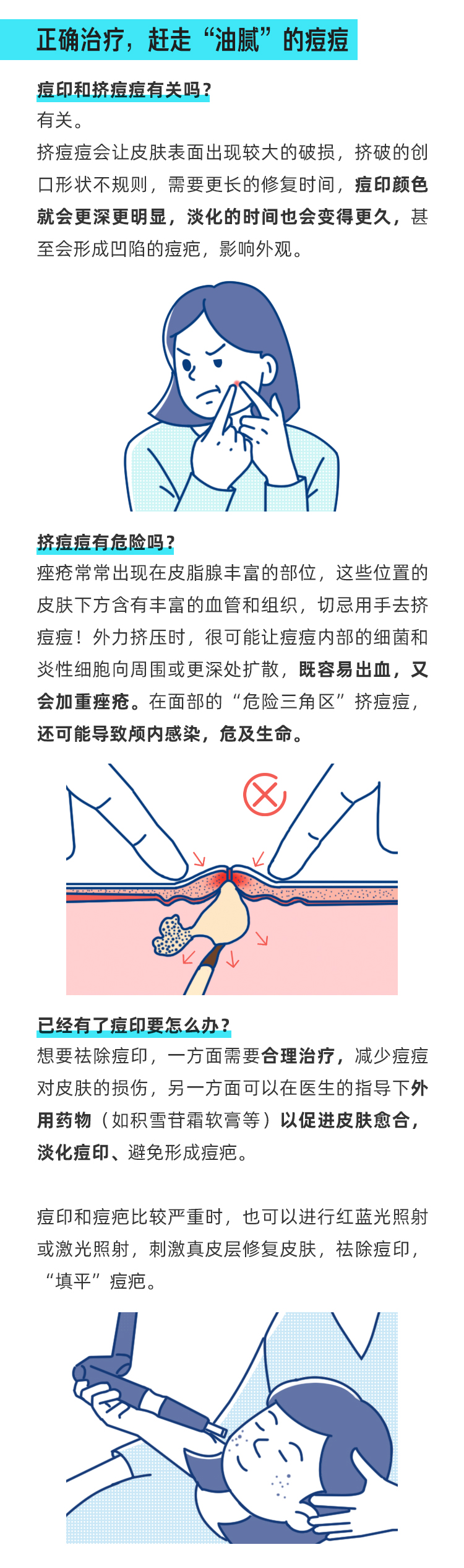 正确应对春季痘痘，拒绝变成“油腻”青年！_03.jpg