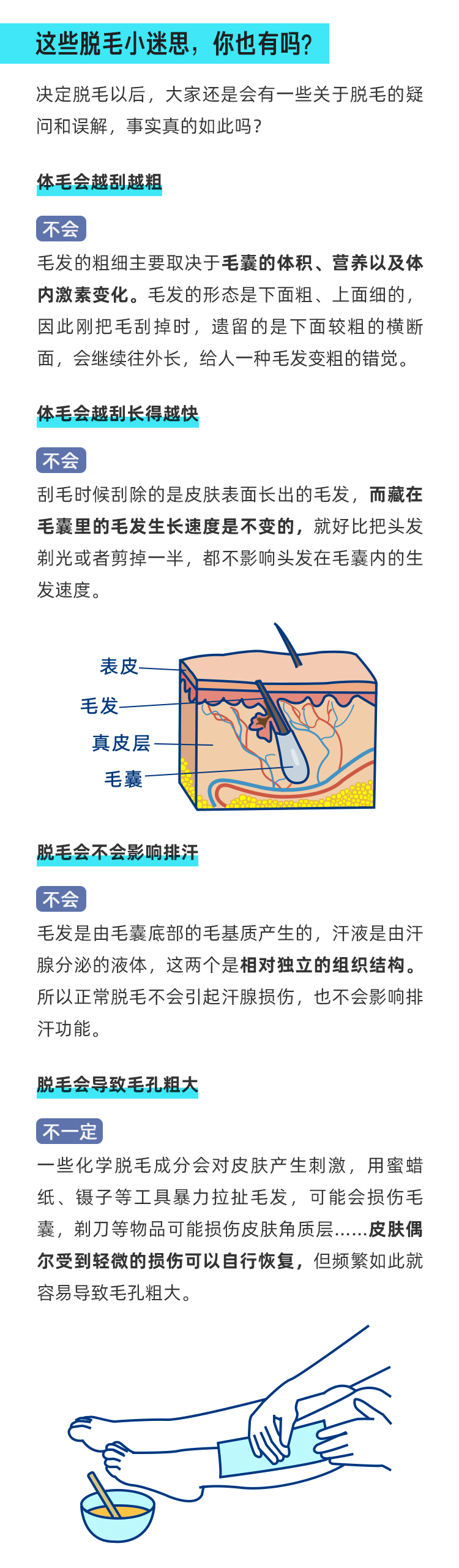 夏天「毛手毛脚」？收好这份脱毛指南_04.jpg