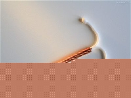 宫内节育环的副作用