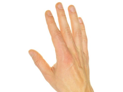 夏天手凉出汗什么原因?