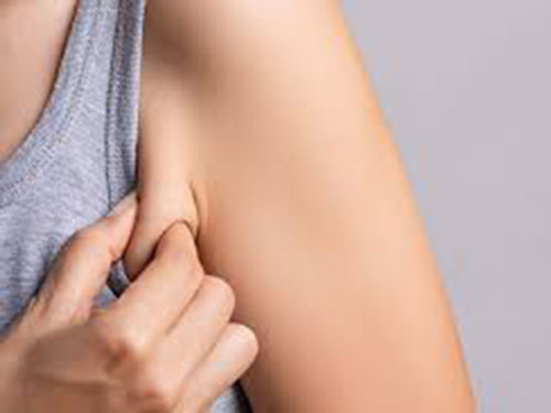 副乳怎么运动消除