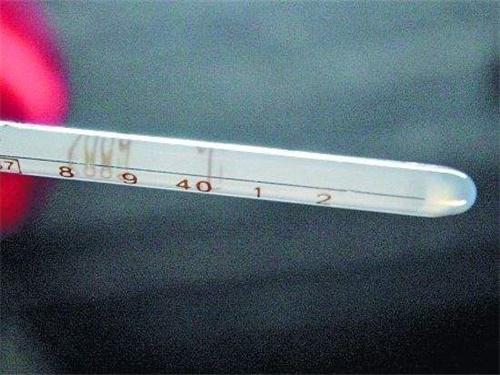 高烧不?€的原???